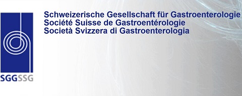 sgg_ssg